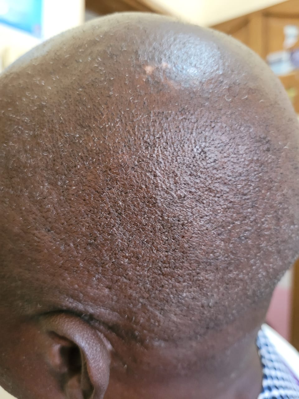 After image