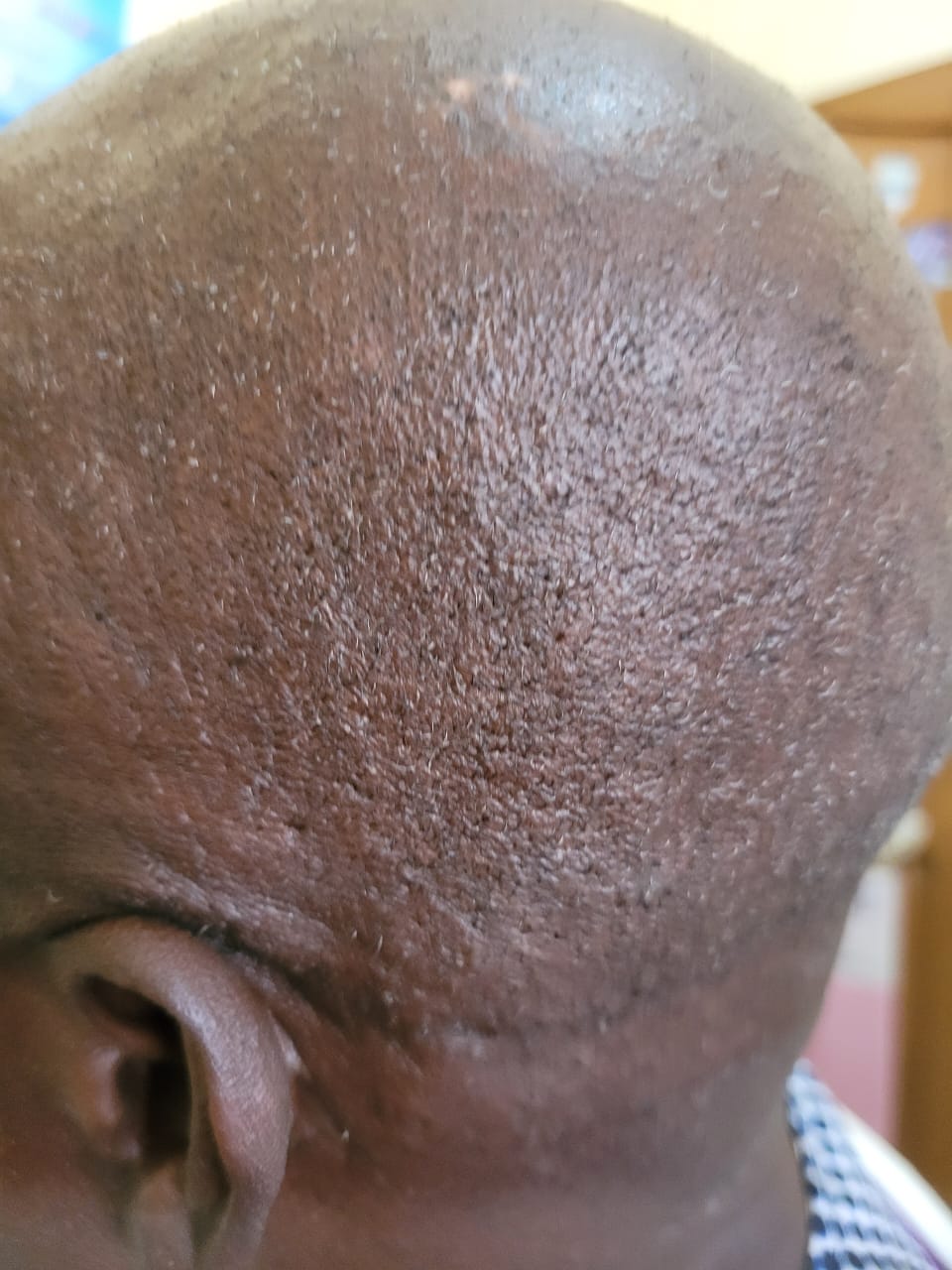 Before image